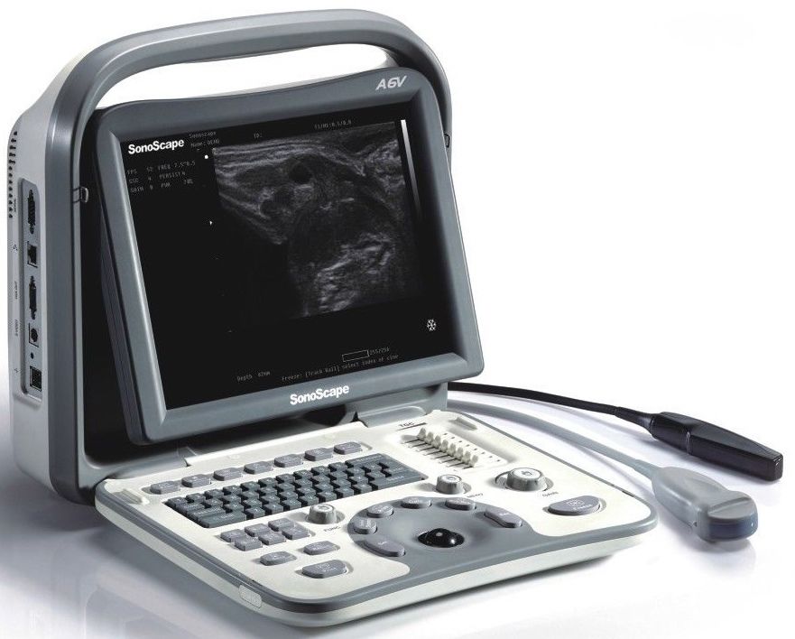 SonoScape A6V Veterinary Ultrasound Scanner Equipment, Probe Choice, Best Deal DIAGNOSTIC ULTRASOUND MACHINES FOR SALE