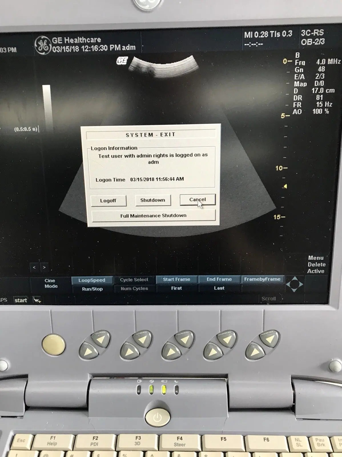 GE Logiq Book XP with 2 x Ultrasound Probes. Linear and Convex 2011 DIAGNOSTIC ULTRASOUND MACHINES FOR SALE