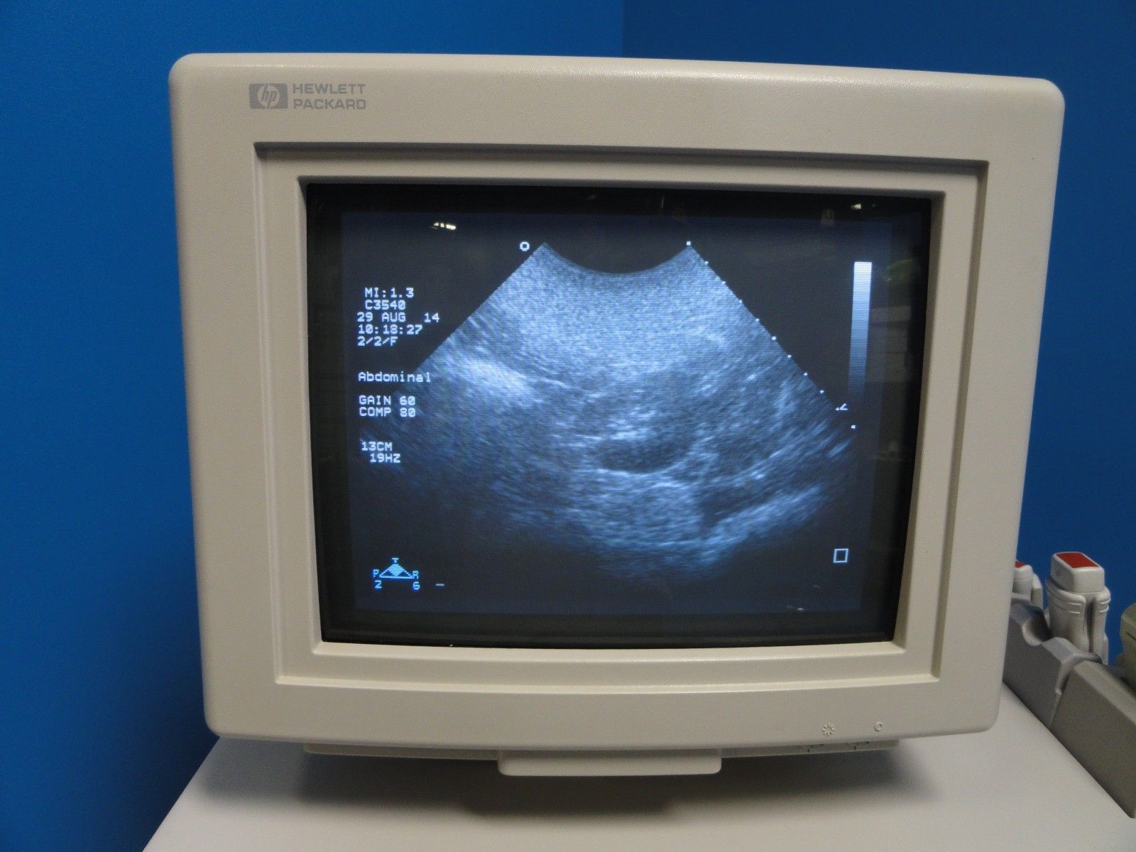 a small monitor with a picture of a body part on it