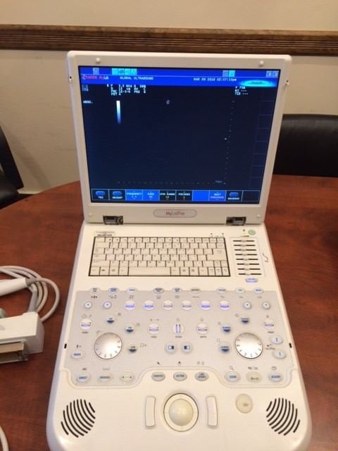 Esaote MyLab Five Portable Ultrasound machine including 2 probes   DIAGNOSTIC ULTRASOUND MACHINES FOR SALE