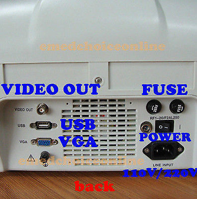 Portable Machine Digital Ultrasound Scanner Transvaginal Probe 3D Software Price 190891982230 DIAGNOSTIC ULTRASOUND MACHINES FOR SALE