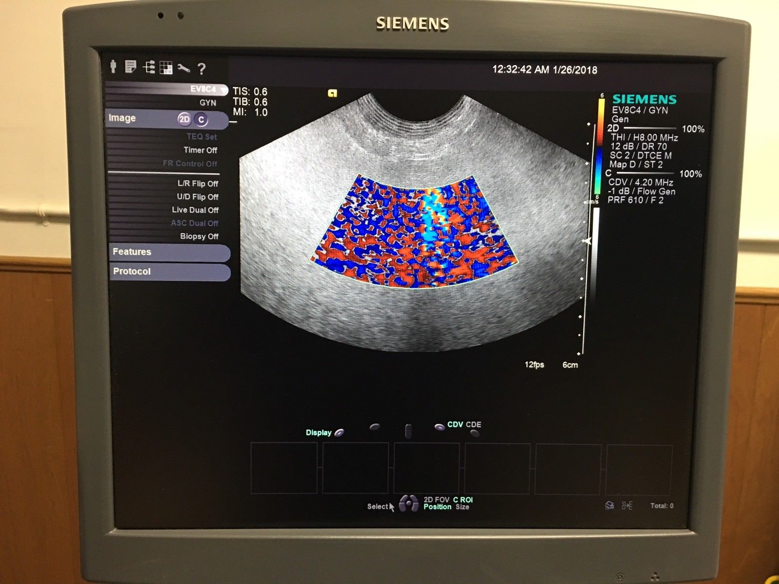 Ultrasound probe SIEMENS ACUSON EV-8C4 DIAGNOSTIC ULTRASOUND MACHINES FOR SALE