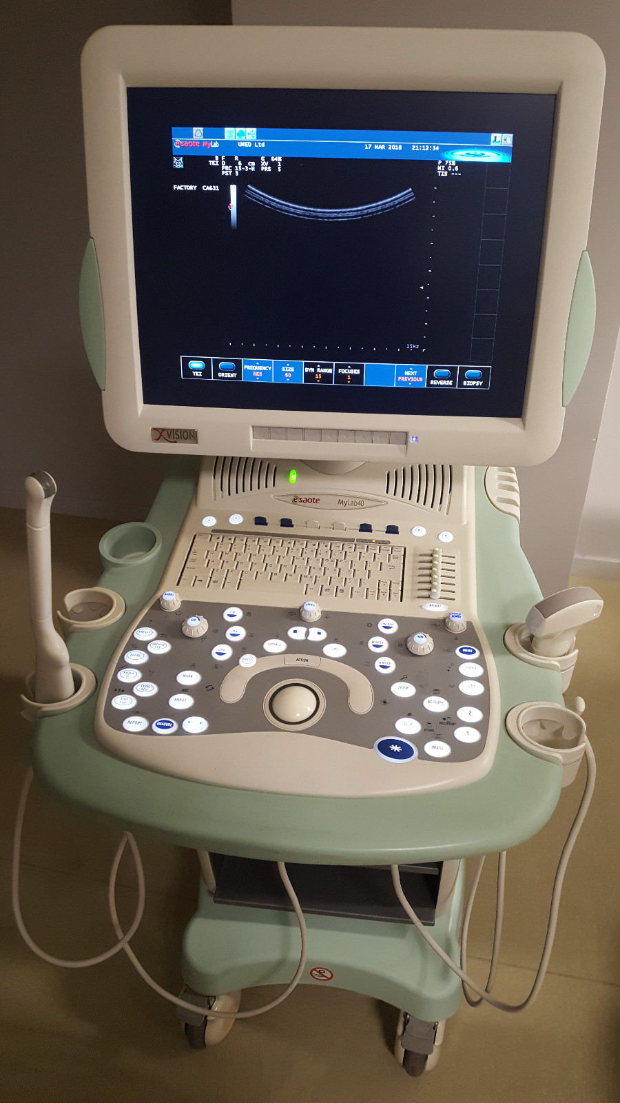 Biosound / Esaote MyLab 40 Diagnostic Ultrasound unit OB / GYN DIAGNOSTIC ULTRASOUND MACHINES FOR SALE