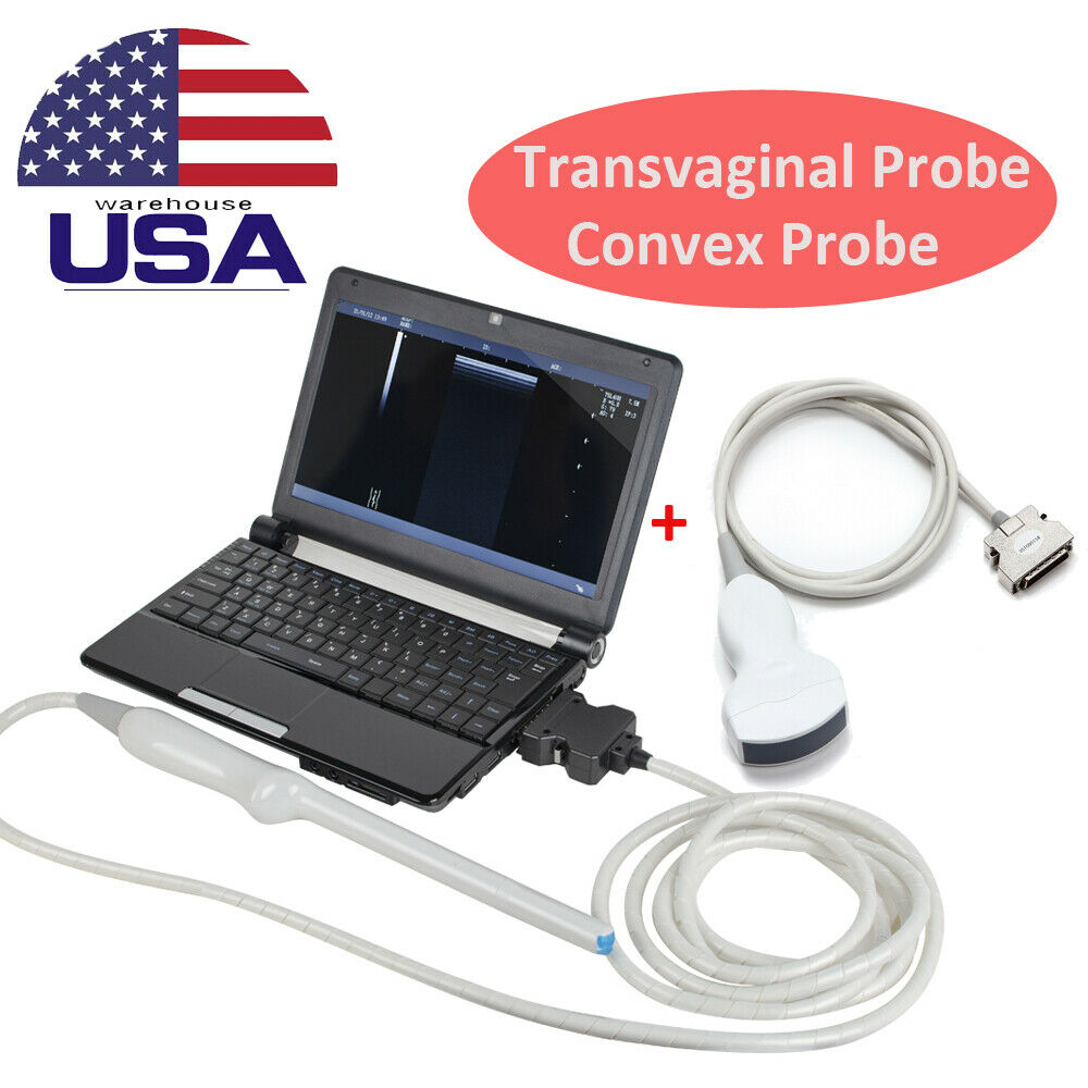 10" Portable Digital Laptop Ultrasound Scanner Machine Convex Transvaginal Probe DIAGNOSTIC ULTRASOUND MACHINES FOR SALE