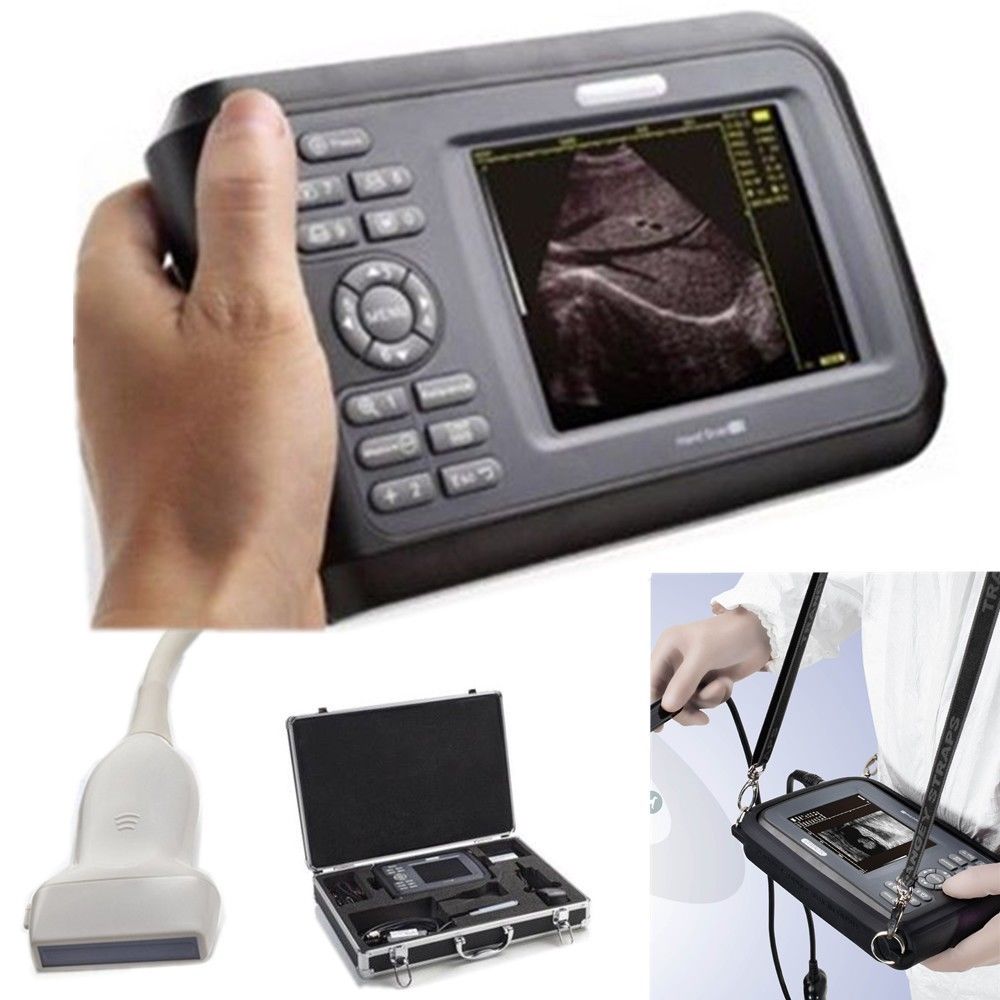 Laptop HandScan Digital Ultrasound Scanner system 7.5Mhz Linear Probe