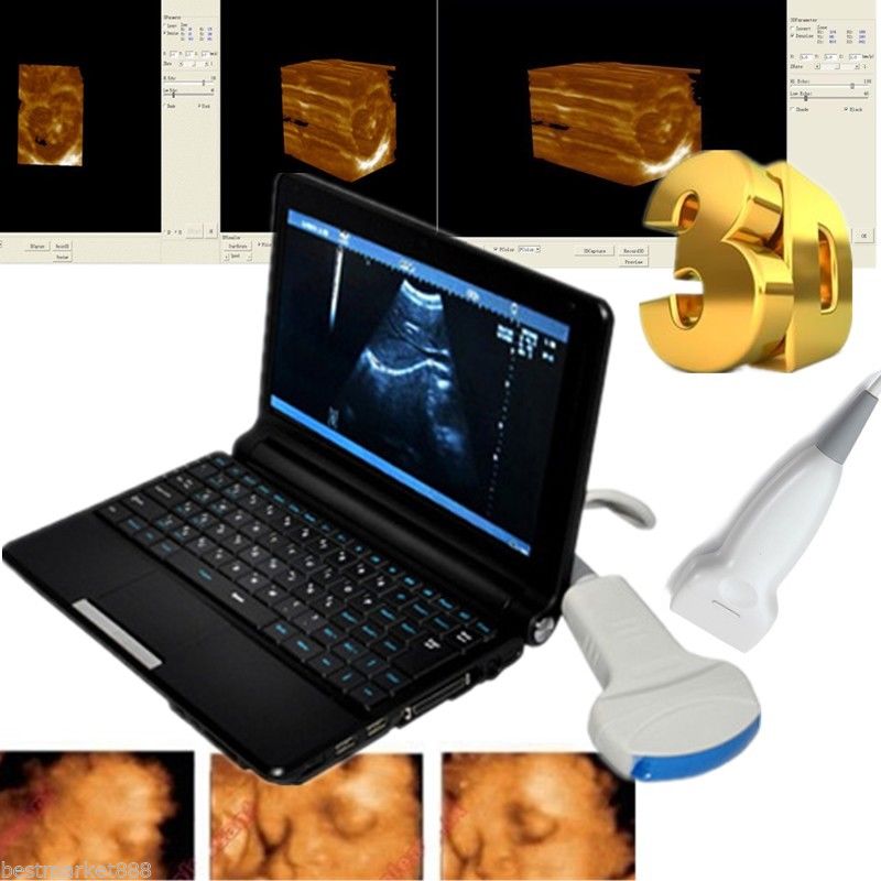 Digital Laptop Ultrasound Scanner with Convex Probe+Linear probe +3D