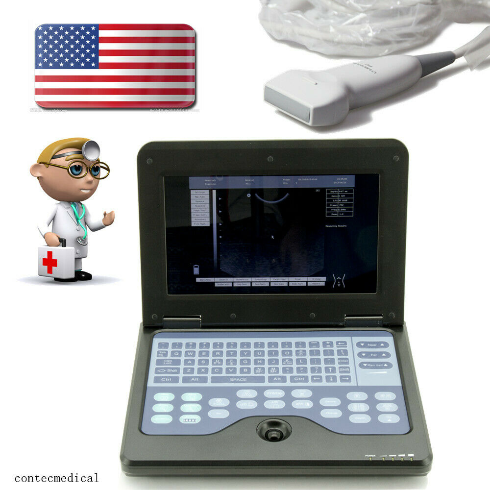 Digital Ultrasound Scanner with 7.5MHz Linear Probe Laptop B-Ultrasound Machine DIAGNOSTIC ULTRASOUND MACHINES FOR SALE