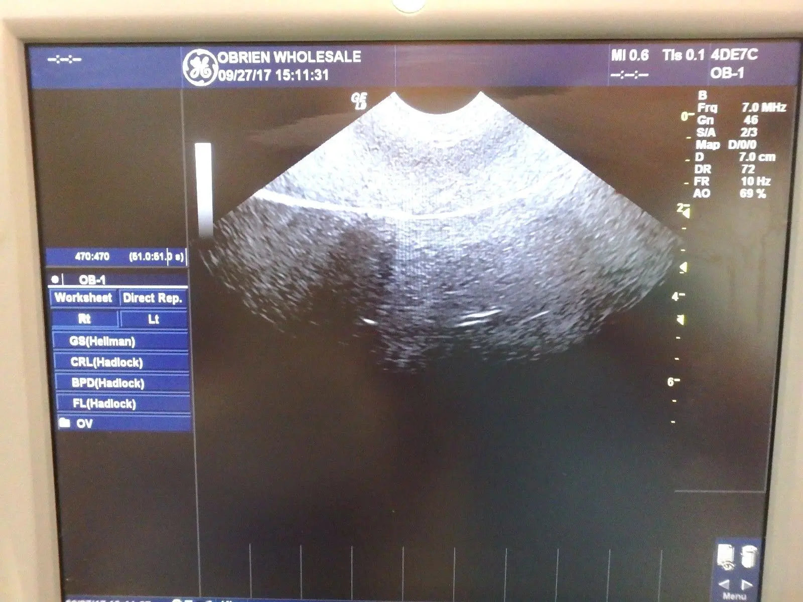 GE 4DE7C Endovaginal Ultrasound Transducer Probe 3D/4D DIAGNOSTIC ULTRASOUND MACHINES FOR SALE