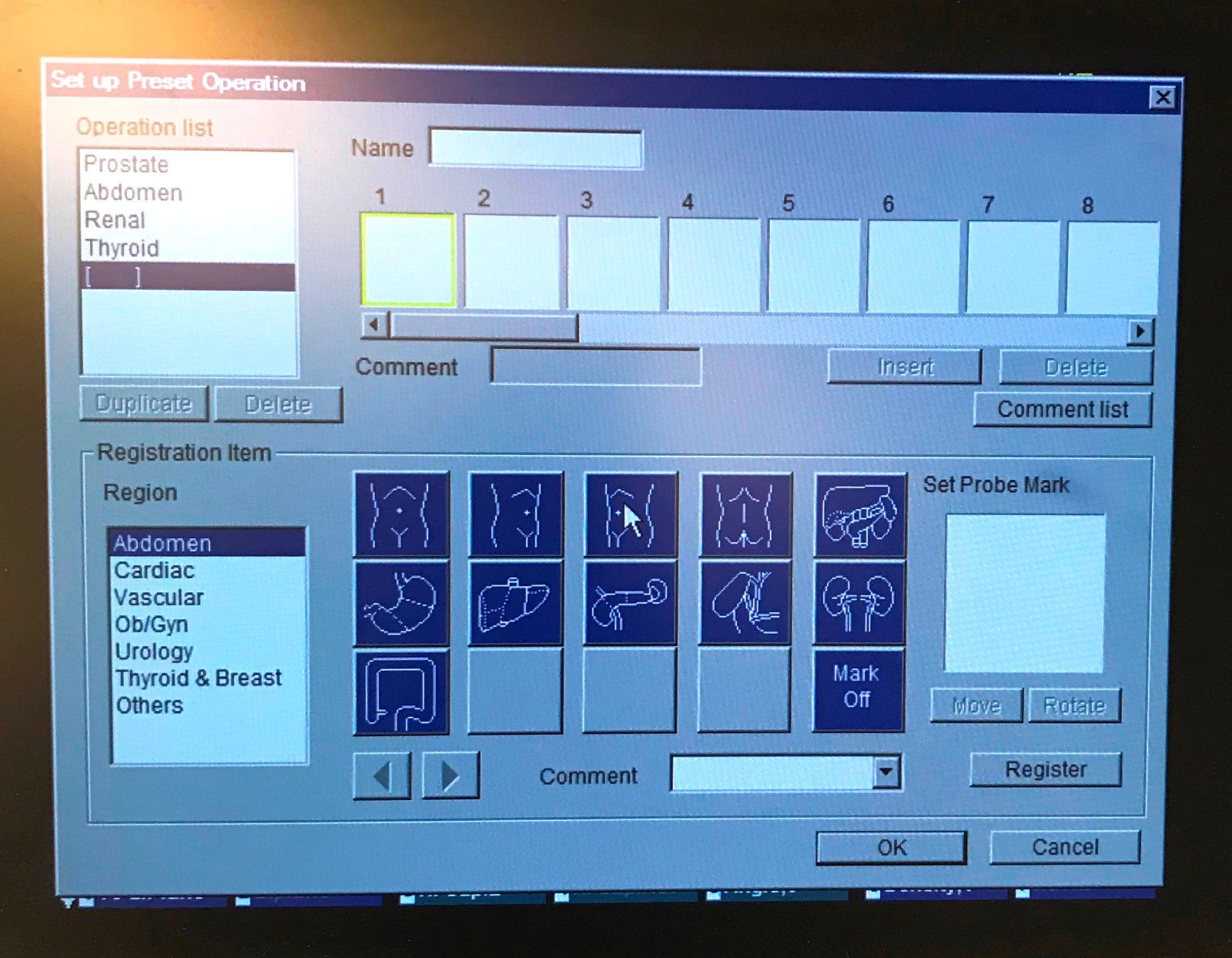 Hitachi HI Vision 5500 Ultrasound Diagnostic Scanner EUB-5500 w/ 3 Transducers DIAGNOSTIC ULTRASOUND MACHINES FOR SALE