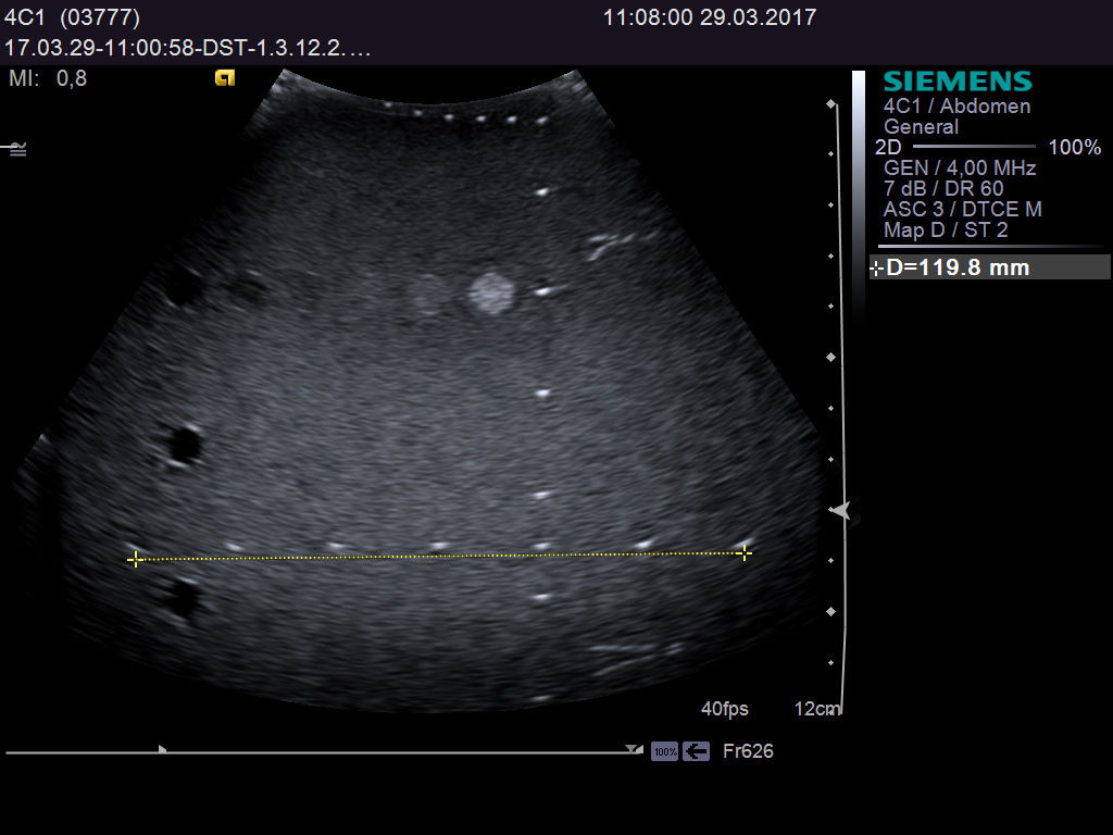 Ultrasound probe SIEMENS Acuson 4C1 DIAGNOSTIC ULTRASOUND MACHINES FOR SALE