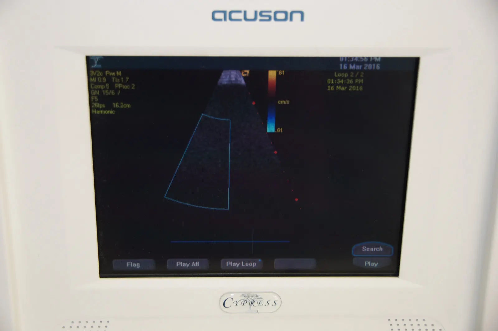 Acuson Cypress Ultrasound System DIAGNOSTIC ULTRASOUND MACHINES FOR SALE