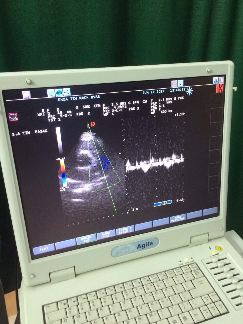 Esaote Biosound Megas/ MyLab ultrasound PA240 Phase Array probe DIAGNOSTIC ULTRASOUND MACHINES FOR SALE