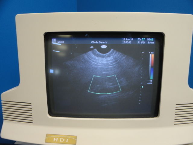 image of probe