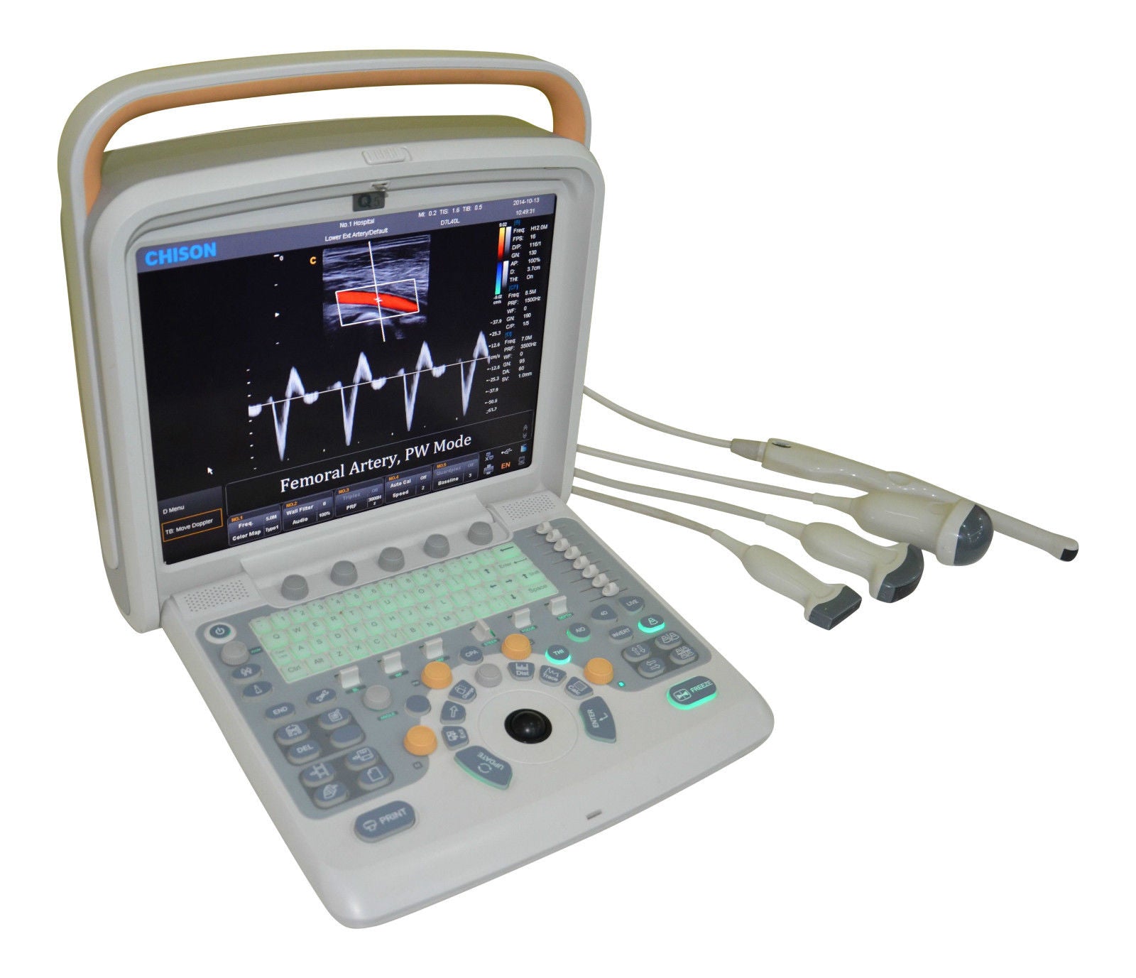 Color Doppler Ultrasound Scanner & Two probes Convex&Linear Probe - Chison Q5 DIAGNOSTIC ULTRASOUND MACHINES FOR SALE