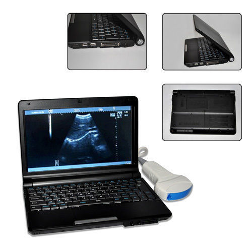 Digital Laptop Notebook Ultrasound Scanner+Convex+Linear+TranVagin Probe 10" LCD DIAGNOSTIC ULTRASOUND MACHINES FOR SALE