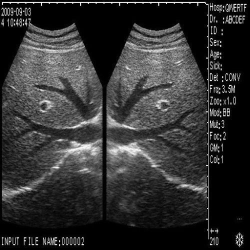 Kit Diagnostic Ultrasound Scanner Machine Convex +Transvaginal 2 Probe + Gift 3D 190891422446 DIAGNOSTIC ULTRASOUND MACHINES FOR SALE